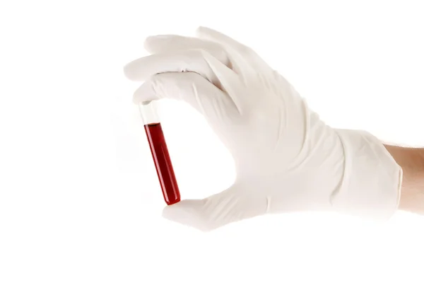 Guanto a mano del medico con esame del sangue isolato su bianco — Foto Stock