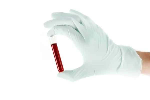 Arzthand im Handschuh mit Bluttest isoliert auf weiß — Stockfoto