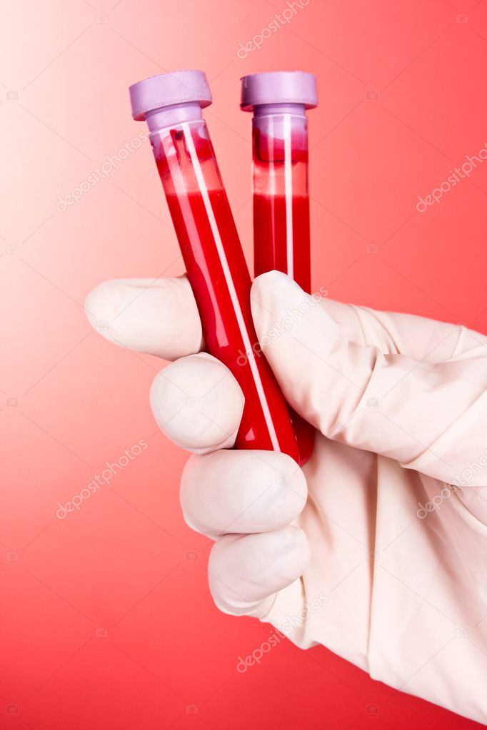 Doctor's hand in glove with blood test tubes on red background