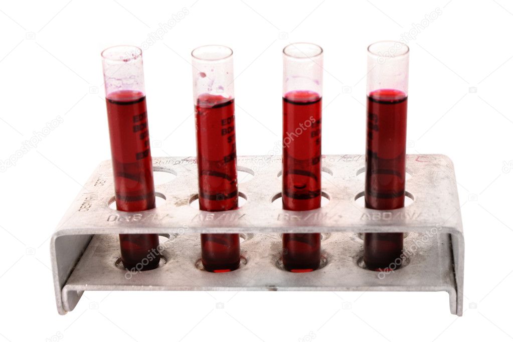 Medical test tubes with violet liquid in holder on white