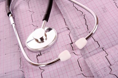 EKG üzerinde stetoskop