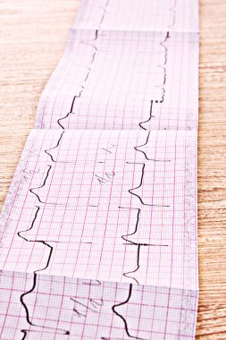 EKG baskı ahşap arka plan üzerinde