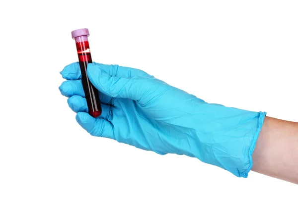 Hand with a test tube — Stock Photo, Image