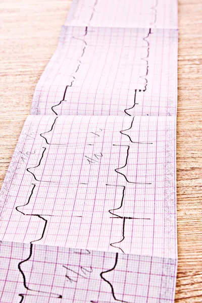 EKG nyomat fából készült háttér — Stock Fotó
