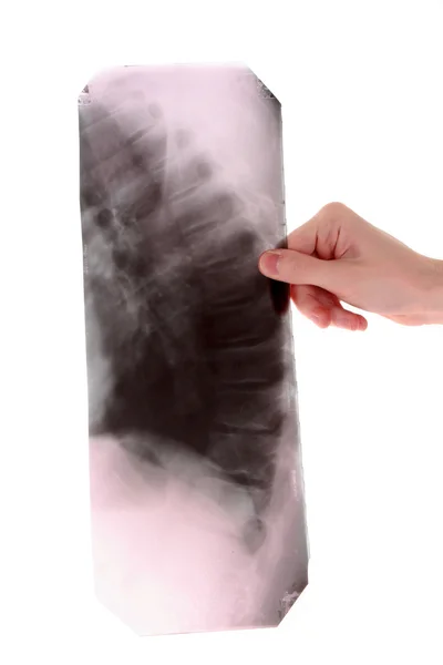Omurga röntgeni üzerinde beyaz izole — Stok fotoğraf