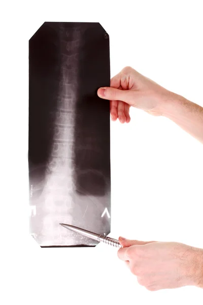 Radiografia della colonna vertebrale isolata su bianco. Mostrando con penna — Foto Stock