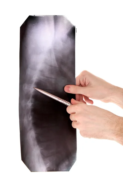 Omurga röntgeni üzerinde beyaz izole. kalemi ile gösterilen — Stok fotoğraf