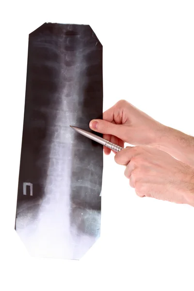 stock image Spine X-ray isolated on white. Showing with pen