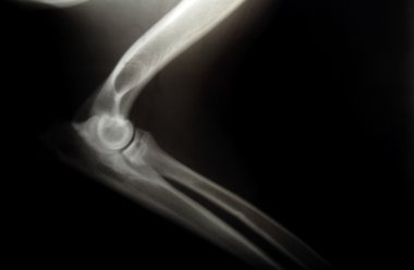 köpek x-ray