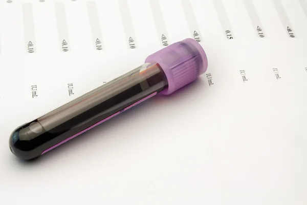 Blood sample — Stock Photo, Image