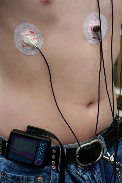 Monitor cardiaco portatile su adolescenti — Foto Stock