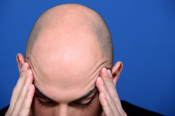 Bald man rubbing his temples — Stock Photo, Image