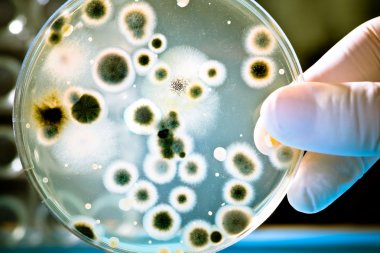 placa de Petri con cultivo de bacterias