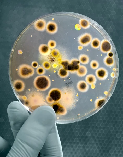 박테리아 문화를 가진 세균 배양 용 접시 — 스톡 사진