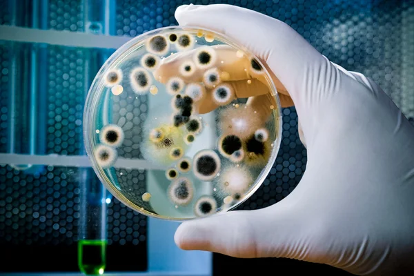 Prato de Petri com cultura de bactérias — Fotografia de Stock