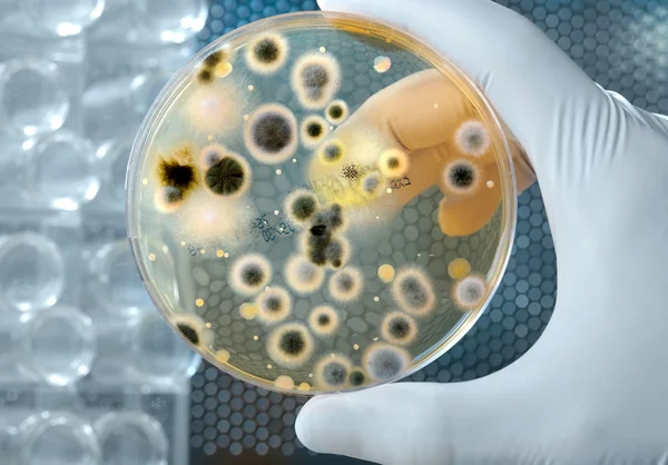 Placa de Petri con cultivo de bacterias — Stok fotoğraf