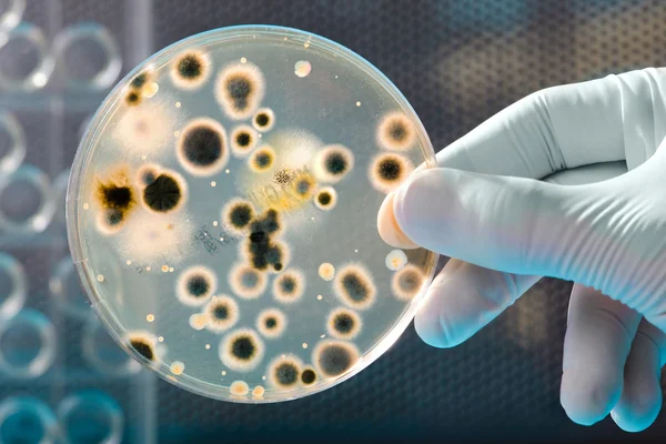 Piatto di Petri con coltura batterica — Foto Stock