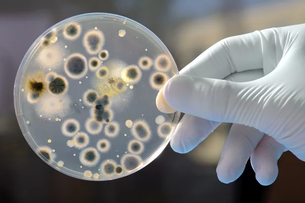 Placa de Petri con cultivo de bacterias — Stok fotoğraf