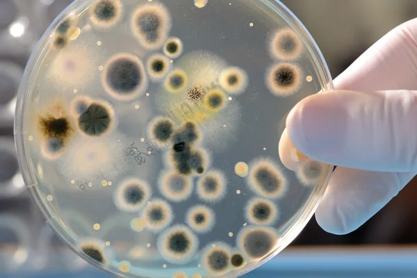 Petri Dish with Bacteria Culture Stock Photo