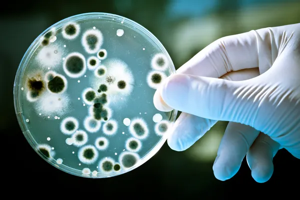 Petri Dish with Bacteria Culture Stock Image