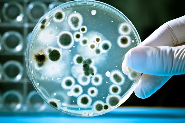 Petri Dish with Bacteria Culture Stock Picture