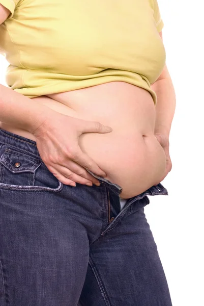 Mulheres com sobrepeso — Fotografia de Stock