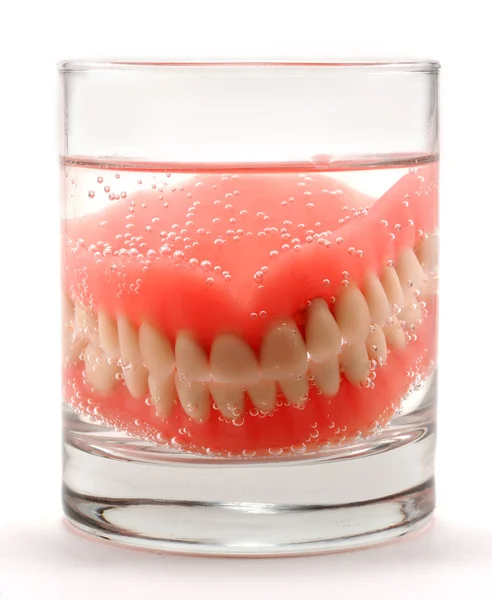 Dentaduras no vidro — Fotografia de Stock
