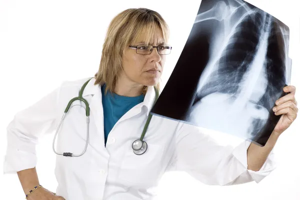 Medico femminile che guarda una radiografia — Foto Stock