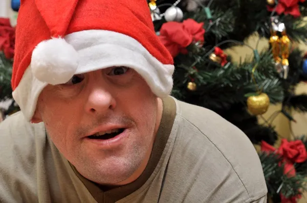 Homem deficiente com chapéu de Pai Natal — Fotografia de Stock