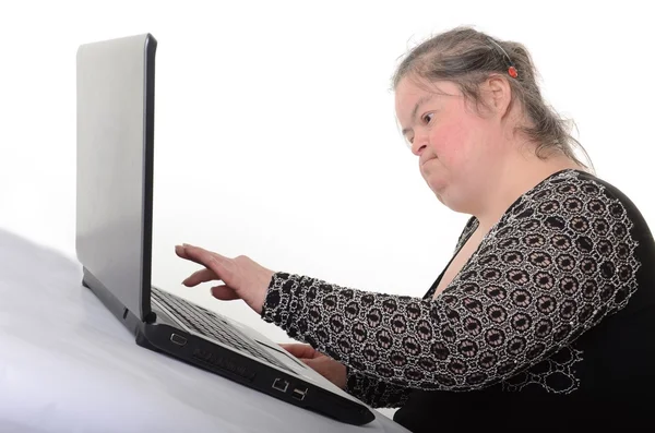 Σύνδρομο Down γυναίκα με φορητό υπολογιστή. απομονώνονται σε λευκό φόντο — Φωτογραφία Αρχείου