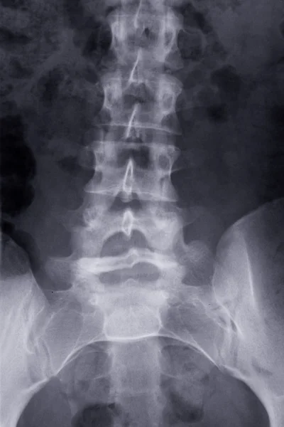 Foto de rayos X — Foto de Stock