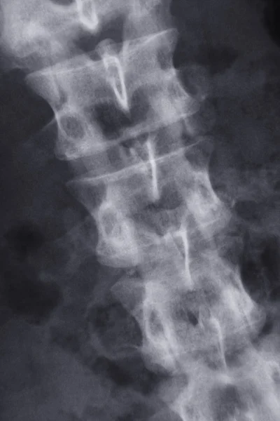 stock image Picture of x-ray