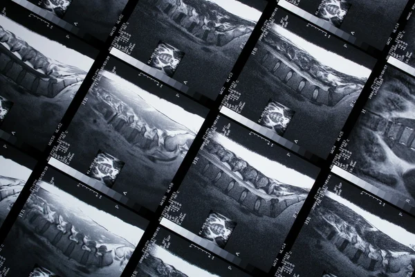 X 線の画像 — ストック写真