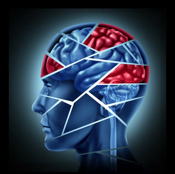 Повреждение мозга — стоковое фото