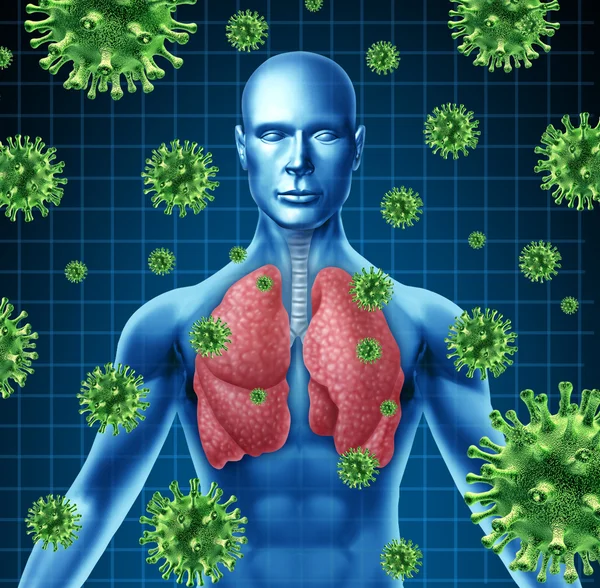 Infección pulmonar — Foto de Stock