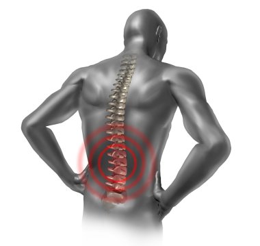 Human back pain clipart