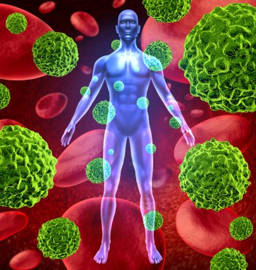 Human body with cancer cells spreading and growing clipart