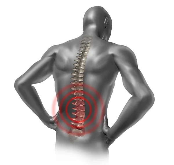 Dolor de espalda humano — Foto de Stock