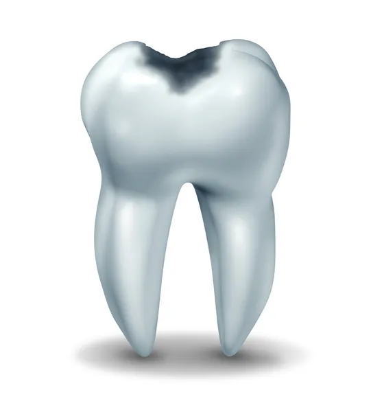 Cavity tooth decay disease symbol — Stock Photo, Image