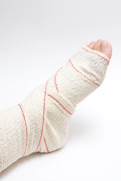 Ayak bandajı — Stok fotoğraf