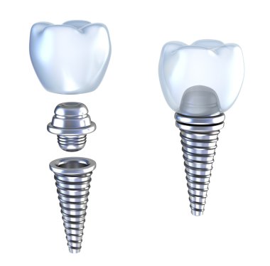 Dental implant lying on surface top side view isolated on white clipart