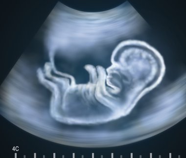 Ultrasound image of baby in mother's womb clipart