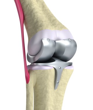 Knee and titanium hinge joint. clipart