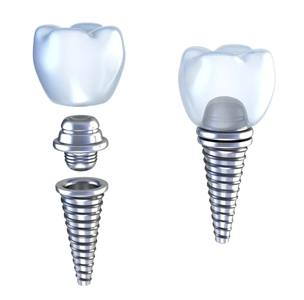 Implante dentário deitado na superfície vista lateral superior isolado em branco — Fotografia de Stock