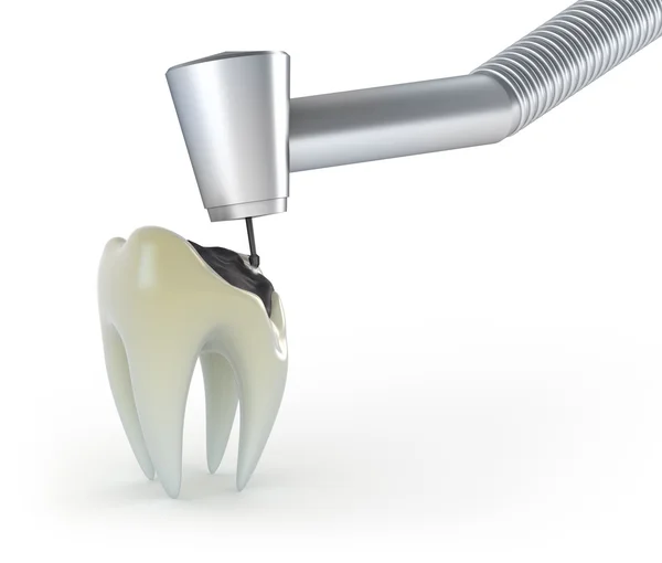 Dentes e instrumentos dentários — Fotografia de Stock