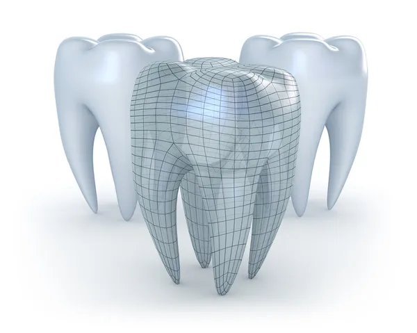 Zähne mit Karies auf weißem Hintergrund. 3D-Bild. — Stockfoto