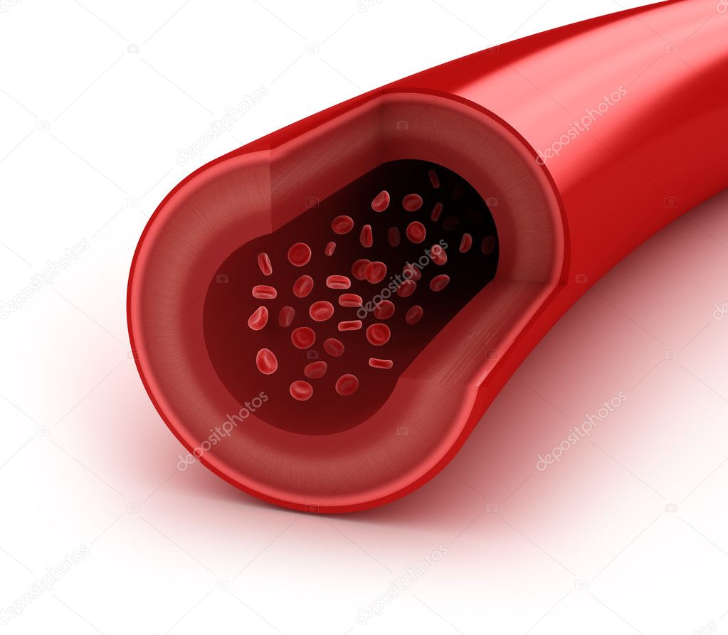 Cholesterol plaque in artery, concept isolated on white