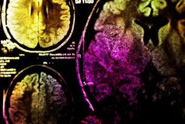 Colorful x-ray scan of brain clipart