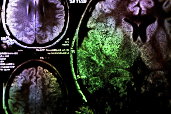 Barevné x-ray skenování mozku — Stock fotografie