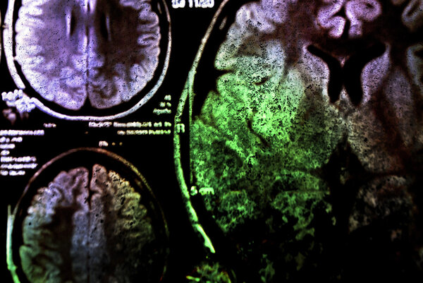 Colorful x-ray scan of brain